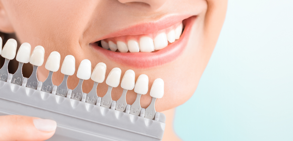what are dental veneers and how do they work