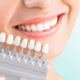 what are dental veneers and how do they work