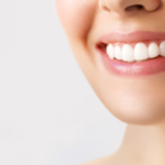 veneers vs. crowns