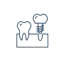 implants