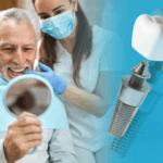 8 signs that you need dental implants