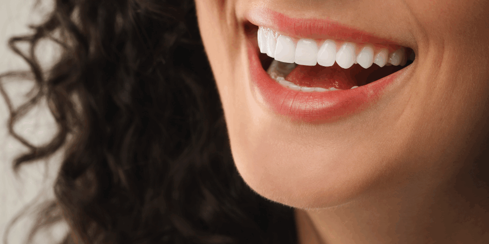 How Long Does It Take to Get Veneers?
